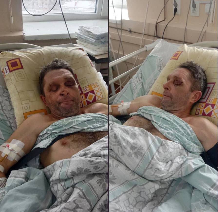 Житель Чернигова после того как попался людоловам кокаинового фюрера Житель Чернигова после того как попался людоловам кокаинового фюрера